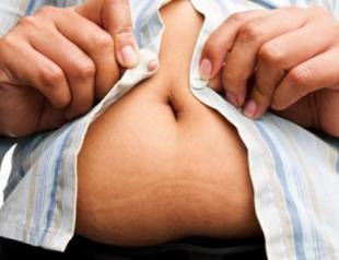 Stretch marks in men: causes and treatment How to avoid stretch marks during pregnancy: prevention methods